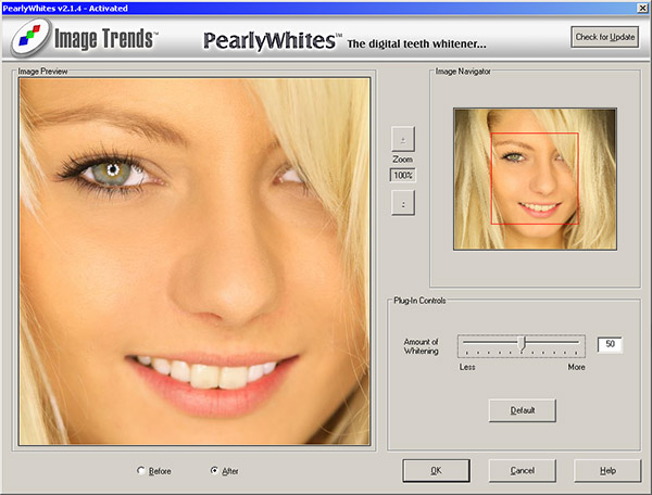 Image Trends PearlyWhites